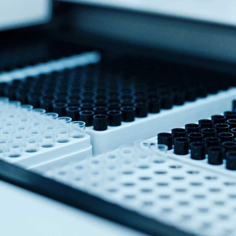 Incubator monitoring