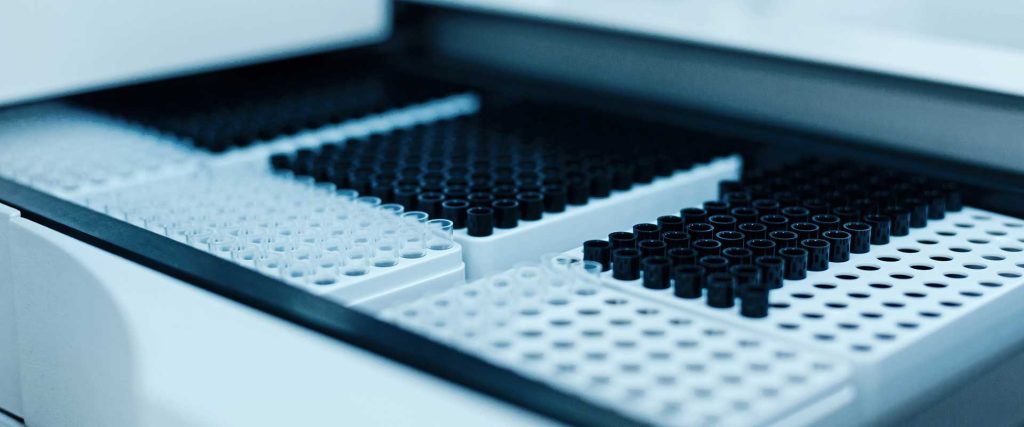Incubator monitoring